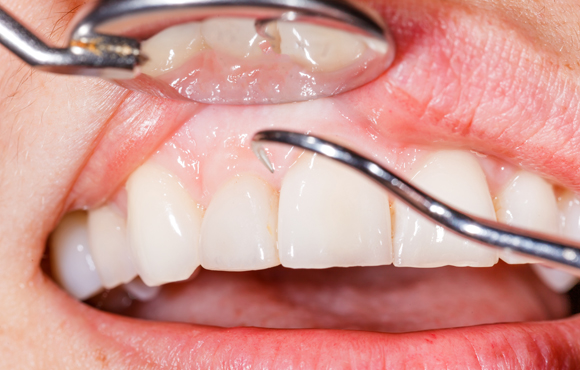 gum disease treatment services